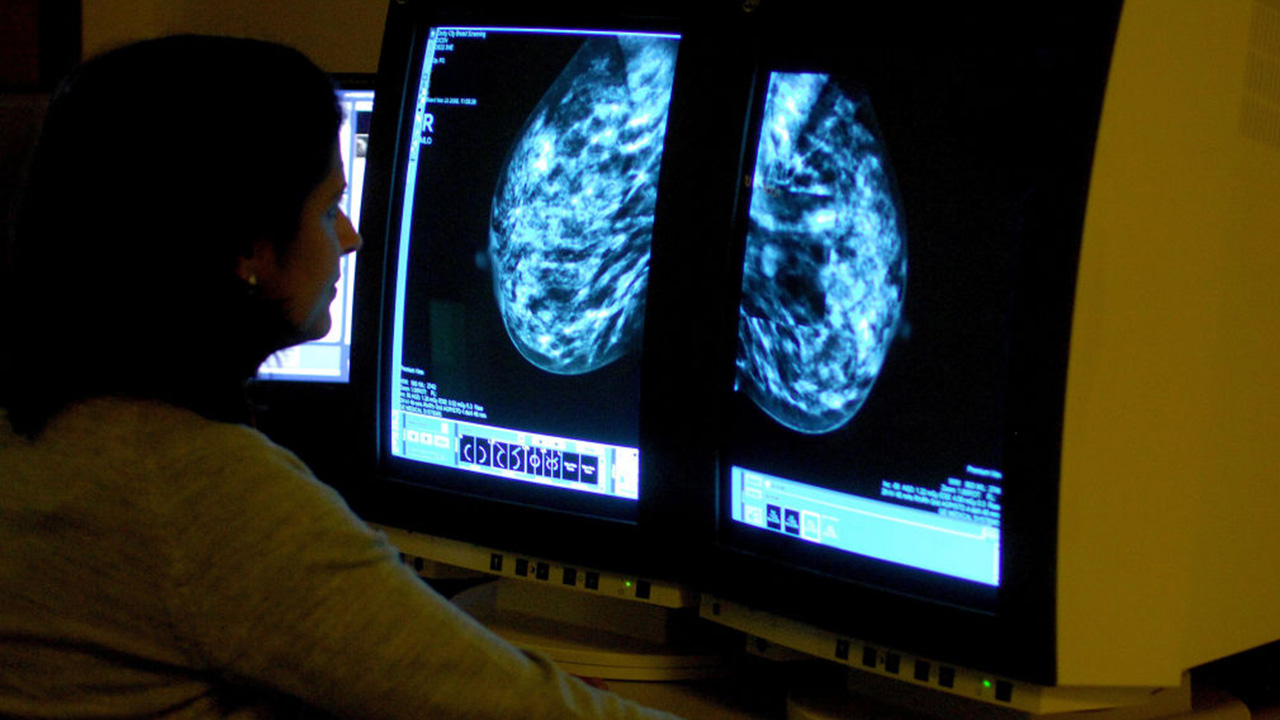 Targeted drug shrinks tumors in 3 out of 4 patients with advanced breast cancer — Land O' Lakes Schools news